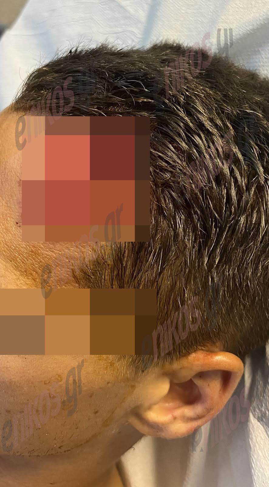 τραυματισμος αστυνομικού οπκε