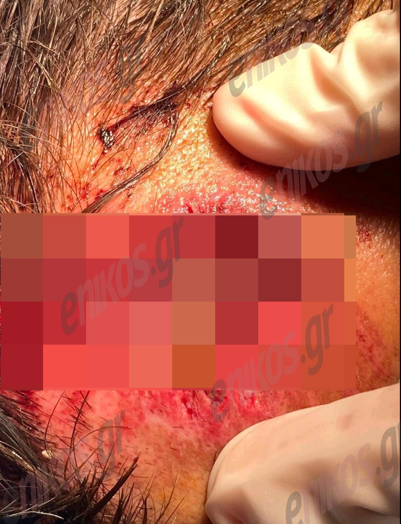 τραυματισμος αστυνομικού οπκε