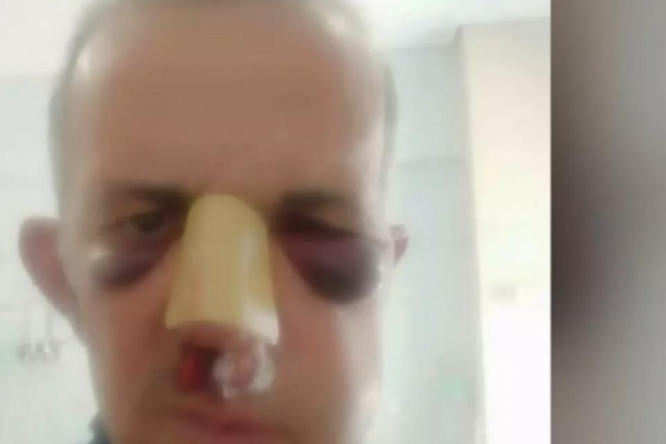 περιστερι ξυλοδαρμος