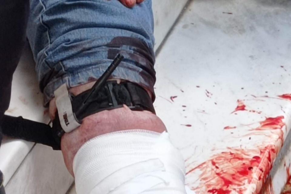 ΠΡΩΤΕς βοηθειες