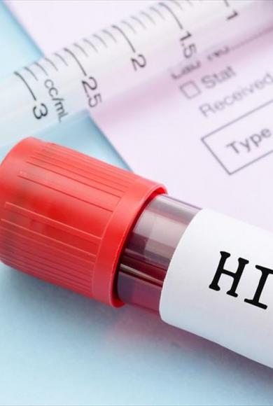 ραπιντ τεστ