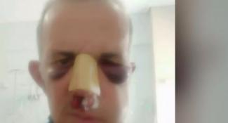 περιστερι ξυλοδαρμος