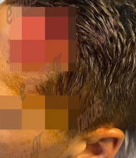 τραυματισμοι αστυνομικών ο.π.κ.ε.