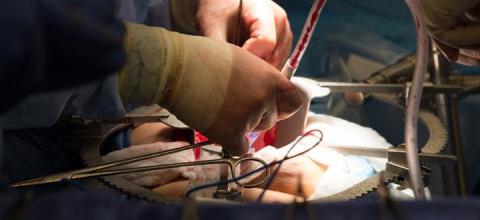 ΜΕΤΑΜΟΣΧΕΥΣΗ ΕΓΧΕΙΡΙΣΗ