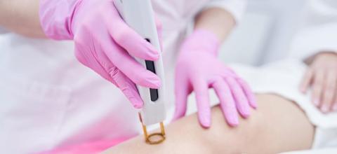 Αποτρίχωση με Laser Alexandrite και έκπτωση 20% για τους αναγνώστες του Policenet.gr από την Total Woman Care