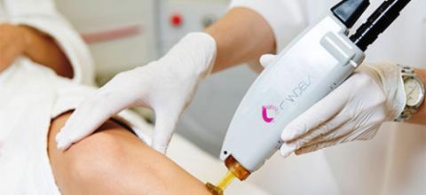 Αποτρίχωση με Laser Alexandrite και έκπτωση 20% για τους αναγνώστες του Policenet.gr από την Total Woman Care